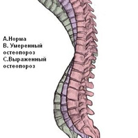 Изображение из форума Академии Wellness загружено пользователем orlova oleya